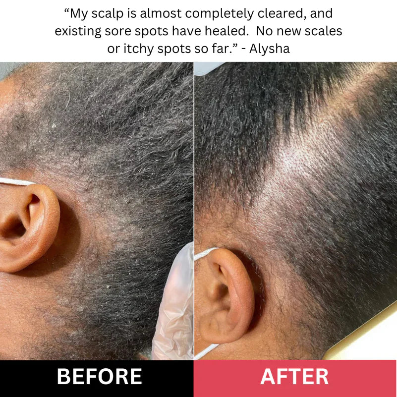Revive+ Restore Scalp Scrub